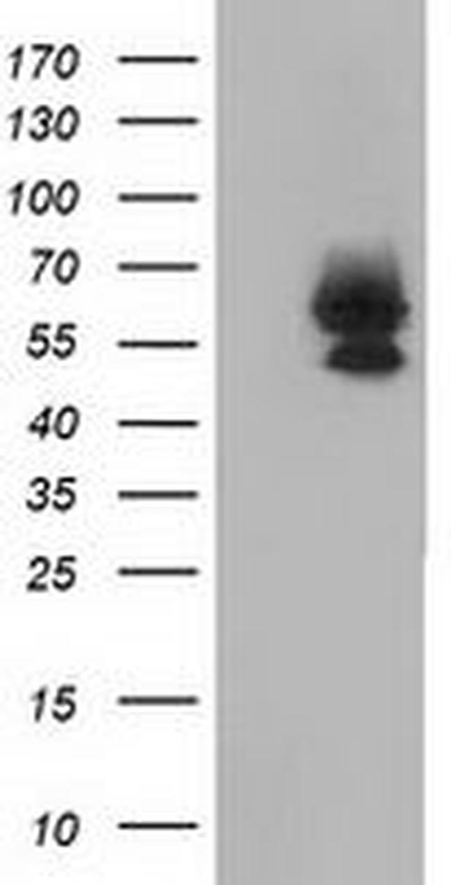 BEST3 Antibody in Western Blot (WB)