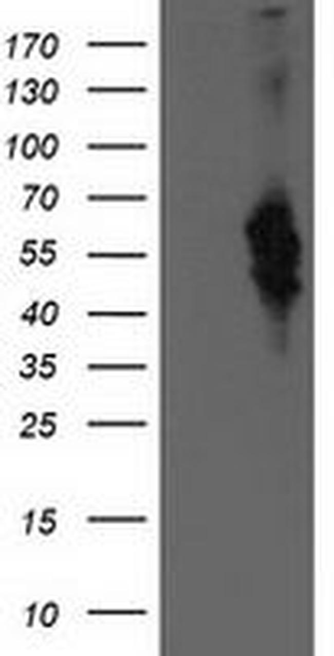 BEST3 Antibody in Western Blot (WB)