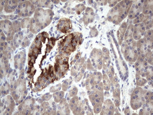 BFSP1 Antibody in Immunohistochemistry (Paraffin) (IHC (P))