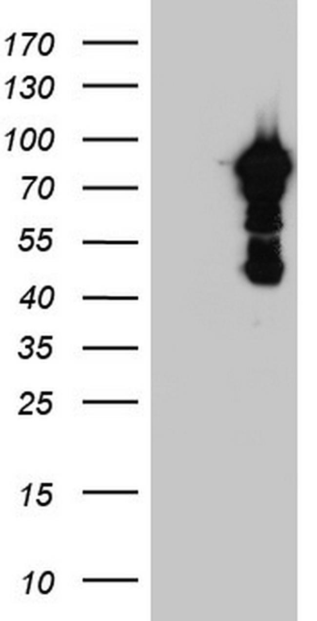 BFSP1 Antibody in Western Blot (WB)