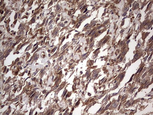 BFSP2 Antibody in Immunohistochemistry (Paraffin) (IHC (P))