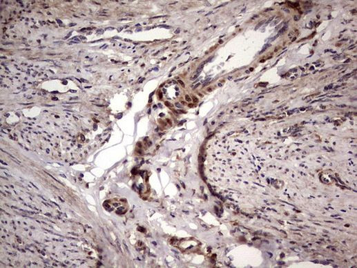 BFSP2 Antibody in Immunohistochemistry (Paraffin) (IHC (P))