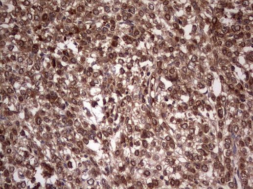 BFSP2 Antibody in Immunohistochemistry (Paraffin) (IHC (P))