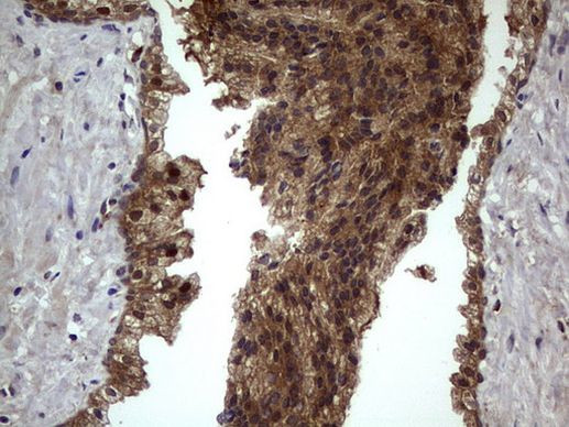 BFSP2 Antibody in Immunohistochemistry (Paraffin) (IHC (P))