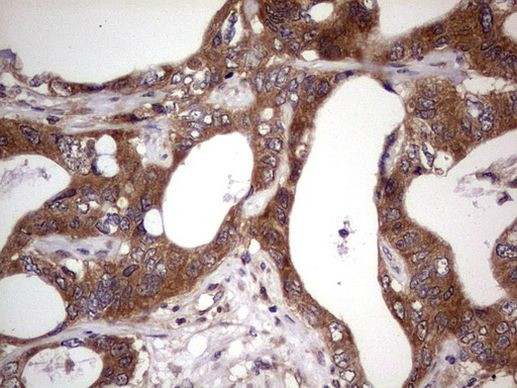 BFSP2 Antibody in Immunohistochemistry (Paraffin) (IHC (P))