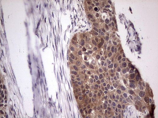 BFSP2 Antibody in Immunohistochemistry (Paraffin) (IHC (P))