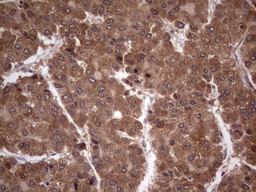 BFSP2 Antibody in Immunohistochemistry (Paraffin) (IHC (P))