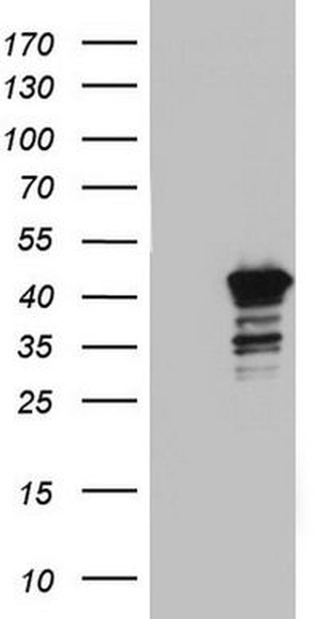 BFSP2 Antibody in Western Blot (WB)