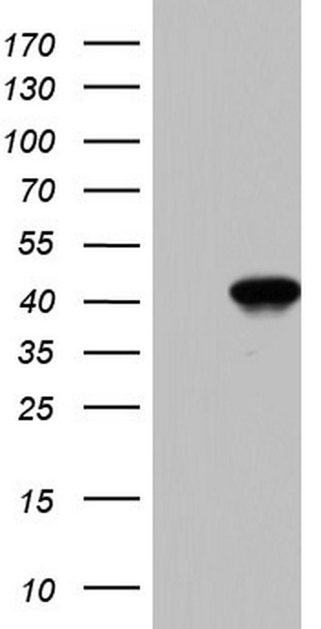 BFSP2 Antibody in Western Blot (WB)