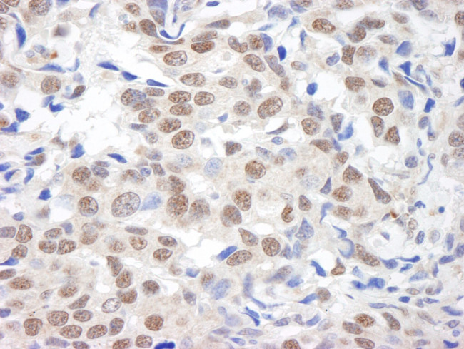 BHC110/LSD1 Antibody in Immunohistochemistry (IHC)