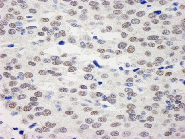 BHC110/LSD1 Antibody in Immunohistochemistry (IHC)