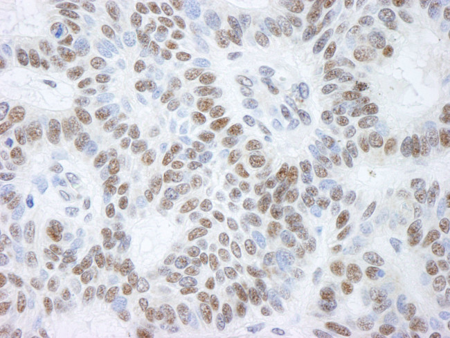 BHC110/LSD1 Antibody in Immunohistochemistry (IHC)