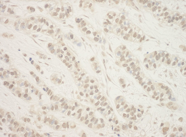 BHD Antibody in Immunohistochemistry (IHC)