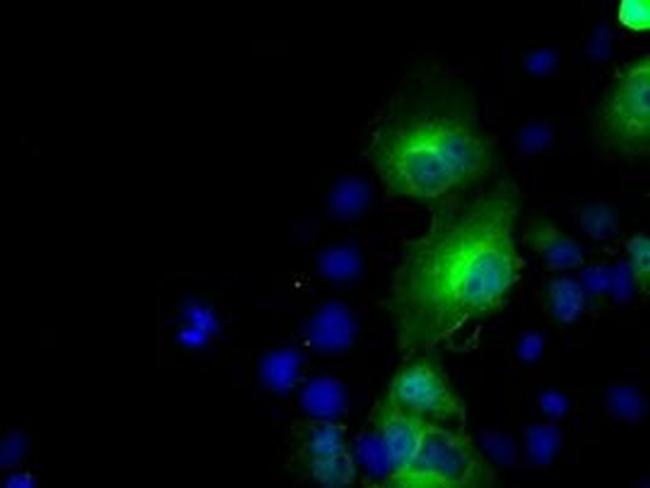 BHMT Antibody in Western Blot (WB)