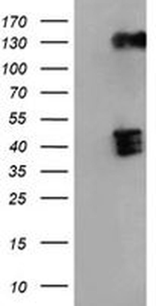 BHMT Antibody in Western Blot (WB)