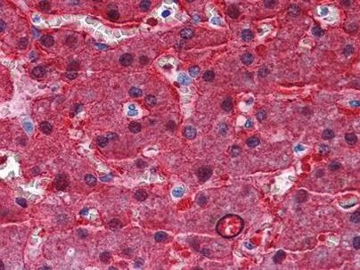 BHMT Antibody in Immunohistochemistry (Paraffin) (IHC (P))