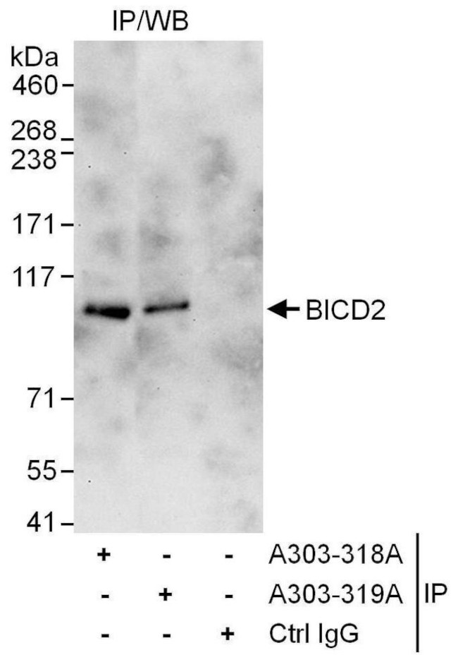 BICD2 Antibody in Immunoprecipitation (IP)