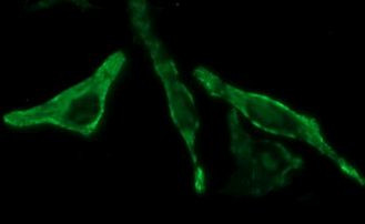 BID Antibody in Immunocytochemistry (ICC/IF)