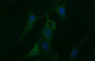 BID Antibody in Immunocytochemistry (ICC/IF)