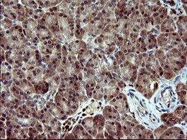 BID Antibody in Immunohistochemistry (Paraffin) (IHC (P))