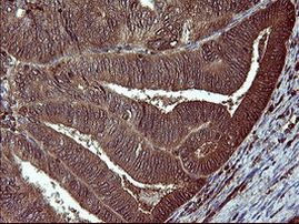 BID Antibody in Immunohistochemistry (Paraffin) (IHC (P))