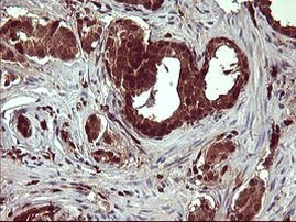 BID Antibody in Immunohistochemistry (Paraffin) (IHC (P))