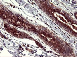 BID Antibody in Immunohistochemistry (Paraffin) (IHC (P))