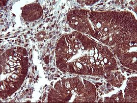 BID Antibody in Immunohistochemistry (Paraffin) (IHC (P))