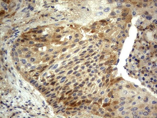 BID Antibody in Immunohistochemistry (Paraffin) (IHC (P))