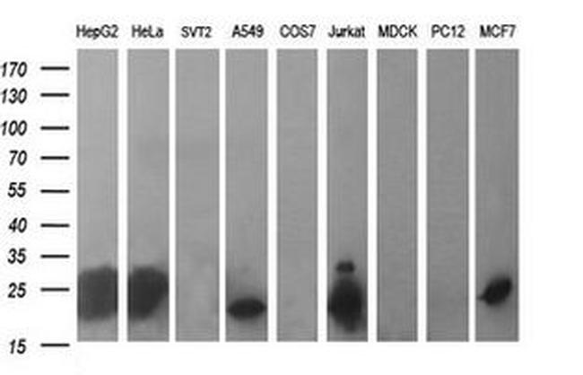 BID Antibody in Western Blot (WB)