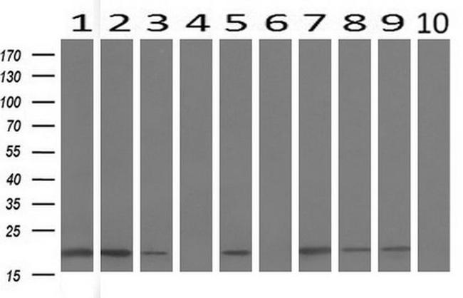 BID Antibody in Western Blot (WB)