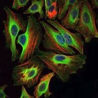 BID Antibody in Immunocytochemistry (ICC/IF)