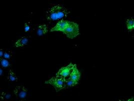 BIN3 Antibody in Immunocytochemistry (ICC/IF)