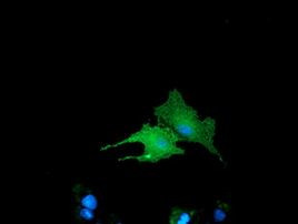 BIN3 Antibody in Immunocytochemistry (ICC/IF)