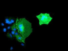 BIN3 Antibody in Immunocytochemistry (ICC/IF)