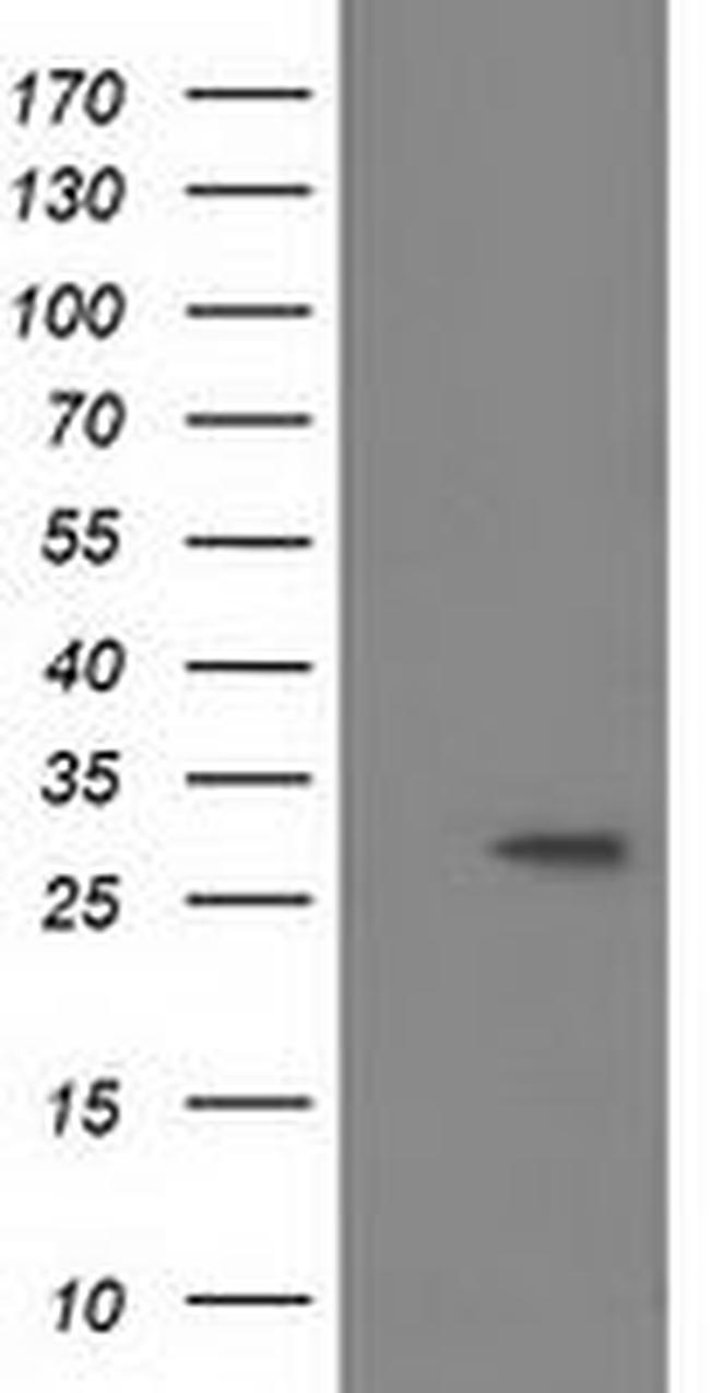 BIN3 Antibody in Western Blot (WB)