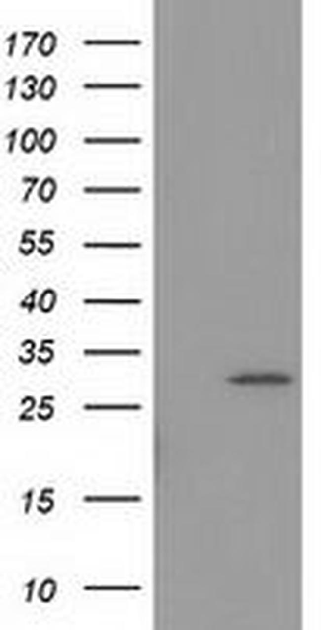 BIN3 Antibody in Western Blot (WB)