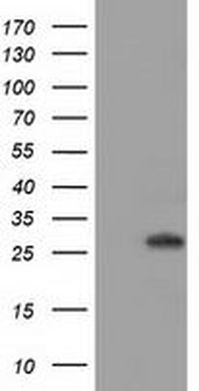 BIN3 Antibody in Western Blot (WB)