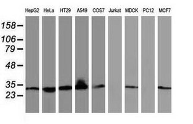 BIN3 Antibody in Western Blot (WB)