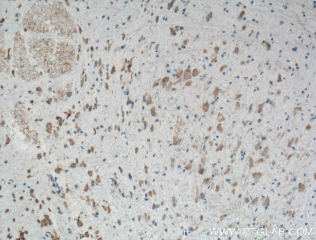 PKM1 Antibody in Immunohistochemistry (Paraffin) (IHC (P))