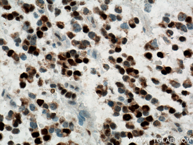 PCNA Antibody in Immunohistochemistry (Paraffin) (IHC (P))