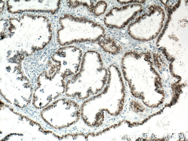 PAX8 Antibody in Immunohistochemistry (Paraffin) (IHC (P))