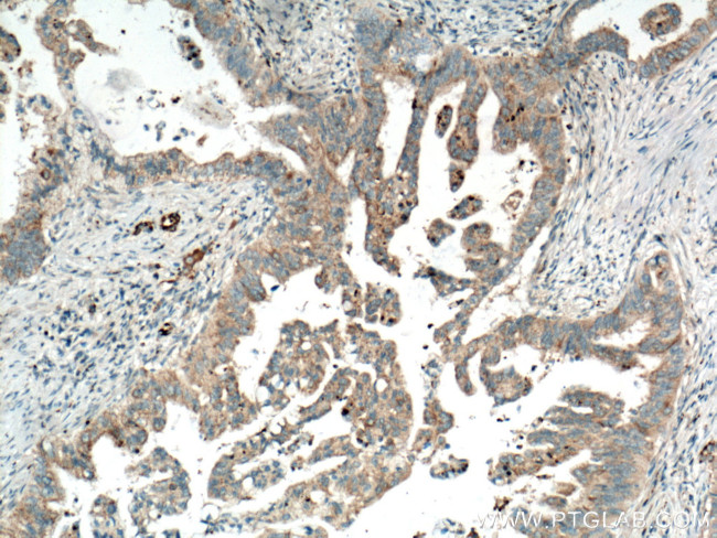 OPTN Antibody in Immunohistochemistry (Paraffin) (IHC (P))