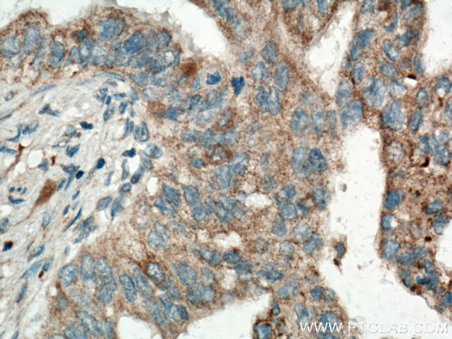 OPTN Antibody in Immunohistochemistry (Paraffin) (IHC (P))