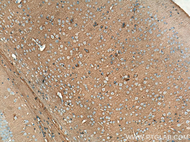 STXBP1 Antibody in Immunohistochemistry (Paraffin) (IHC (P))