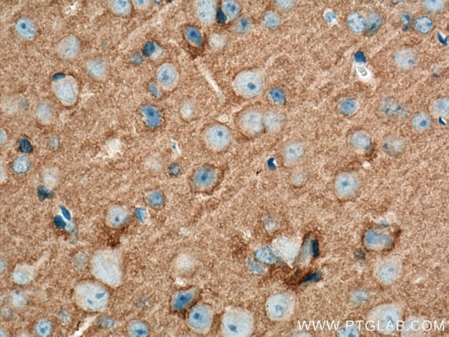 STXBP1 Antibody in Immunohistochemistry (Paraffin) (IHC (P))