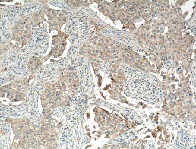 P-cadherin Antibody in Immunohistochemistry (Paraffin) (IHC (P))