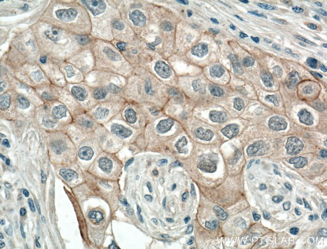 P-cadherin Antibody in Immunohistochemistry (Paraffin) (IHC (P))