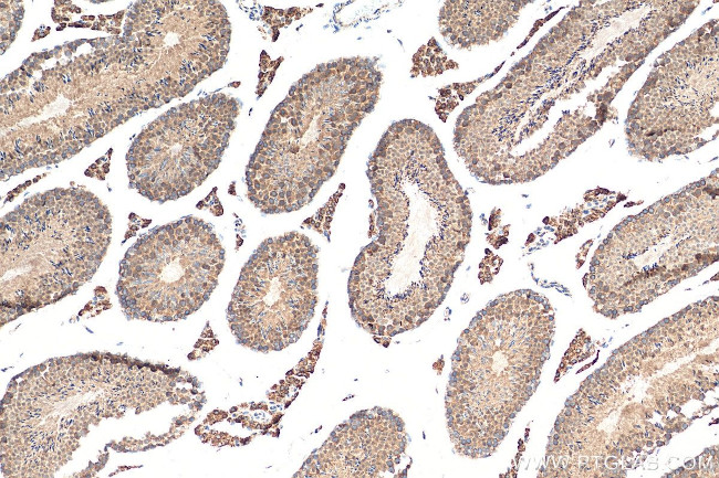 STK25 Antibody in Immunohistochemistry (Paraffin) (IHC (P))