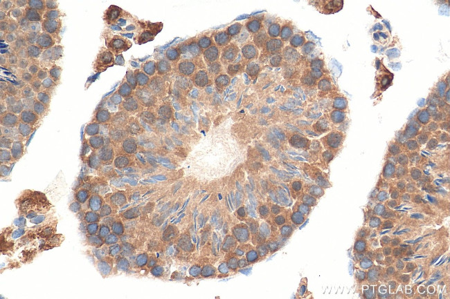 STK25 Antibody in Immunohistochemistry (Paraffin) (IHC (P))